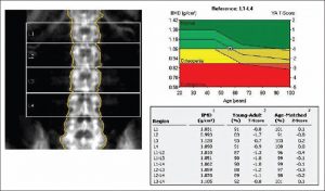 JIndianSocPeriodontol_2017_21_2_119_220752_f2